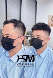 百变大咖如何应对日益严重的脱发问题