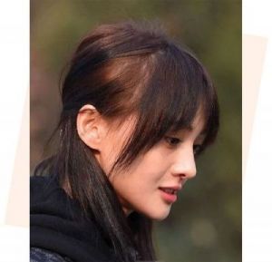 就挺秃然的女星如何应对