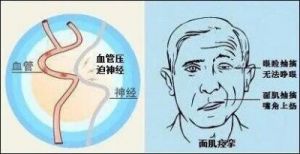 文字寻错：图文指南解决献血难题