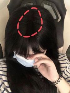 如何穿越这座奇怪的毛发稀疏的长廊？